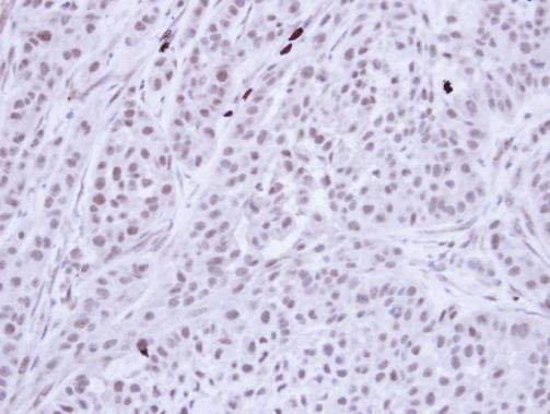 Bub3 Antibody in Immunohistochemistry (Paraffin) (IHC (P))