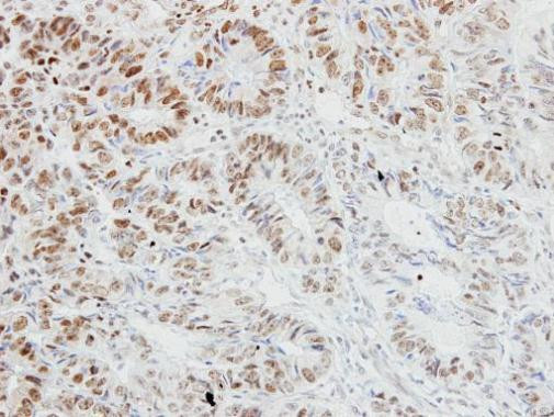 TRAF3IP2 Antibody in Immunohistochemistry (Paraffin) (IHC (P))