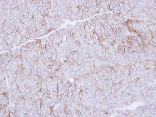 CD147 Antibody in Immunohistochemistry (Paraffin) (IHC (P))