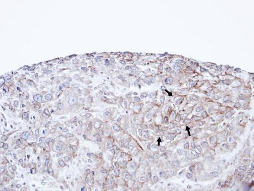 P-cadherin Antibody in Immunohistochemistry (Paraffin) (IHC (P))