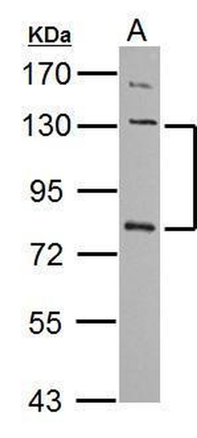 P-cadherin Antibody in Western Blot (WB)