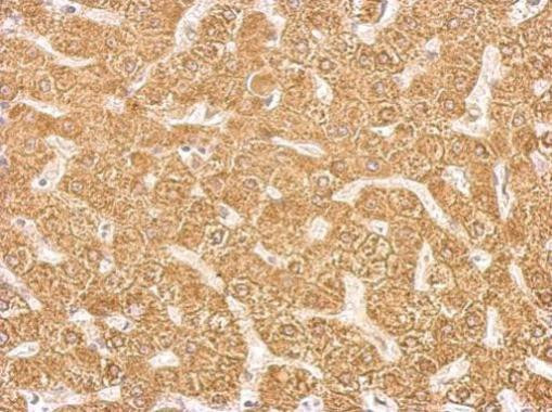 CYP2C8 Antibody in Immunohistochemistry (Paraffin) (IHC (P))