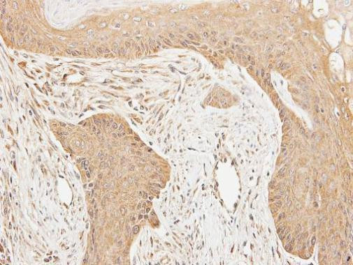 Cortactin Antibody in Immunohistochemistry (Paraffin) (IHC (P))