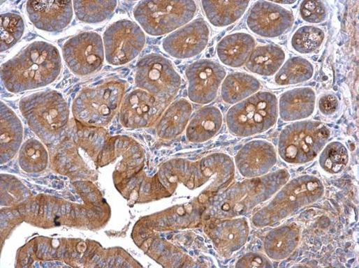 Cortactin Antibody in Immunohistochemistry (Paraffin) (IHC (P))