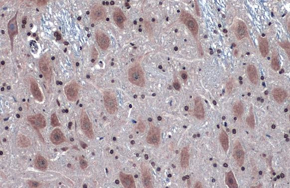 IRE1 alpha Antibody in Immunohistochemistry (Paraffin) (IHC (P))