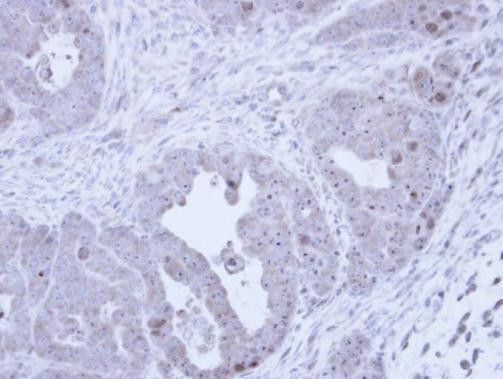 Fibrillarin Antibody in Immunohistochemistry (Paraffin) (IHC (P))