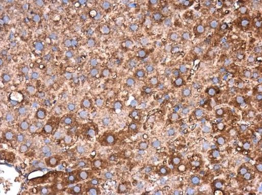 FIBB Antibody in Immunohistochemistry (Paraffin) (IHC (P))