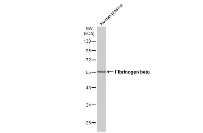 FIBB Antibody in Western Blot (WB)