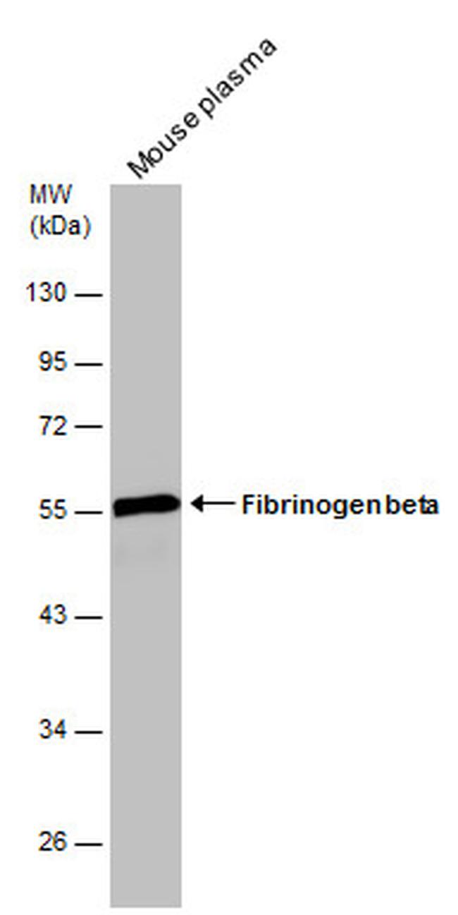 FIBB Antibody in Western Blot (WB)