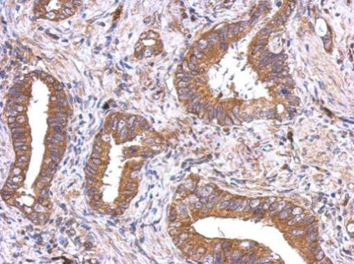 VEGFD Antibody in Immunohistochemistry (Paraffin) (IHC (P))