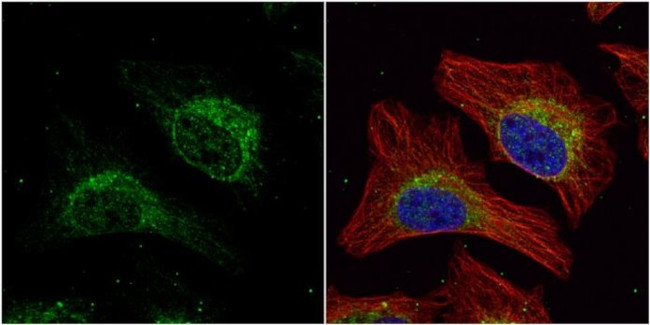 HADHA Antibody in Immunocytochemistry (ICC/IF)