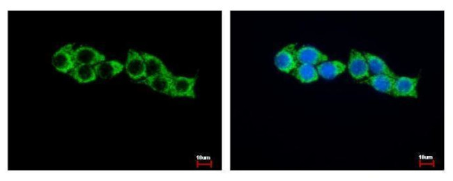 HADHA Antibody in Immunocytochemistry (ICC/IF)