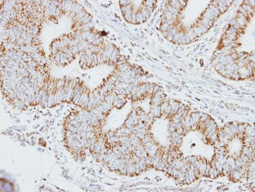 HADHA Antibody in Immunohistochemistry (Paraffin) (IHC (P))