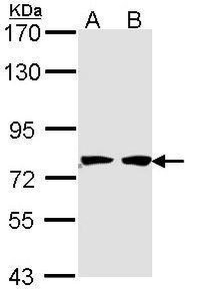 HADHA Antibody in Western Blot (WB)