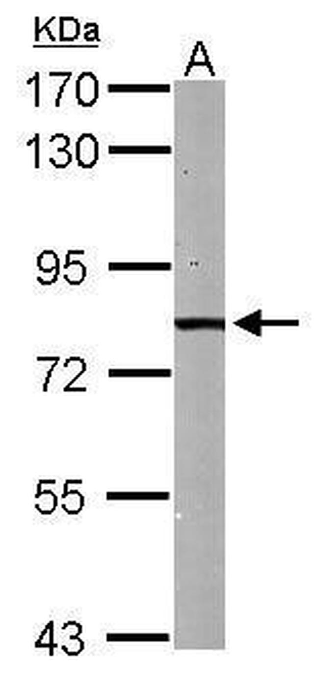 HADHA Antibody in Western Blot (WB)