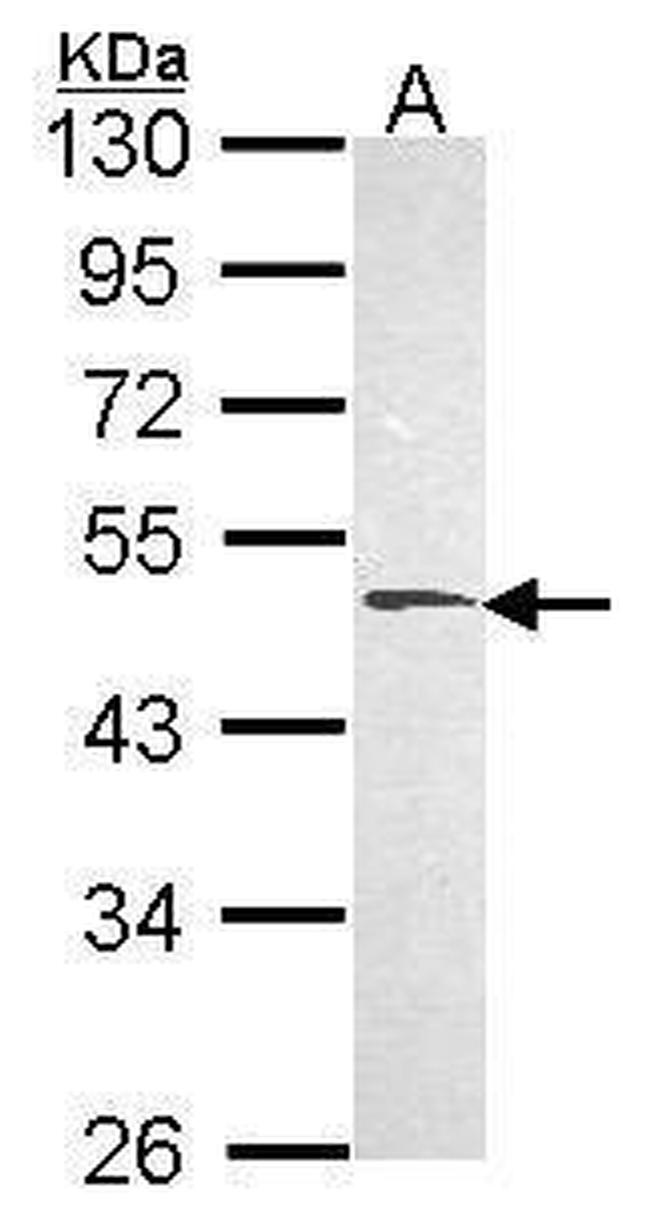 HYAL1 Antibody in Western Blot (WB)