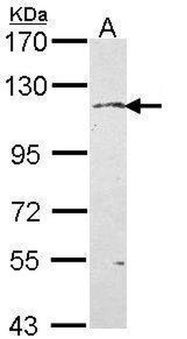 Kinesin 5A Antibody in Western Blot (WB)