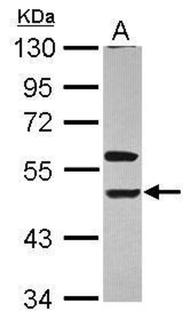 KIR3DL1 Antibody in Western Blot (WB)