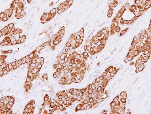 Cytokeratin 4 Antibody in Immunohistochemistry (Paraffin) (IHC (P))