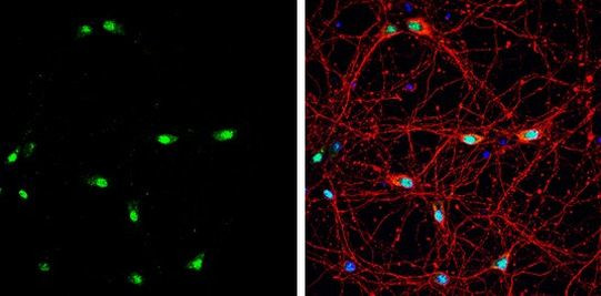 MBNL1 Antibody in Immunocytochemistry (ICC/IF)