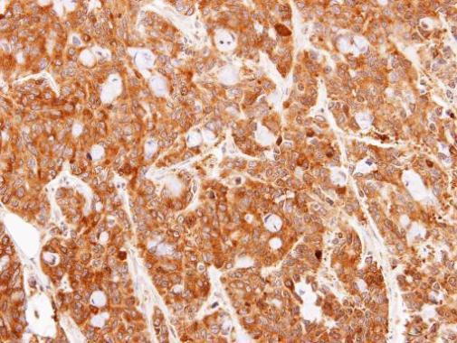 PRDX1 Antibody in Immunohistochemistry (Paraffin) (IHC (P))