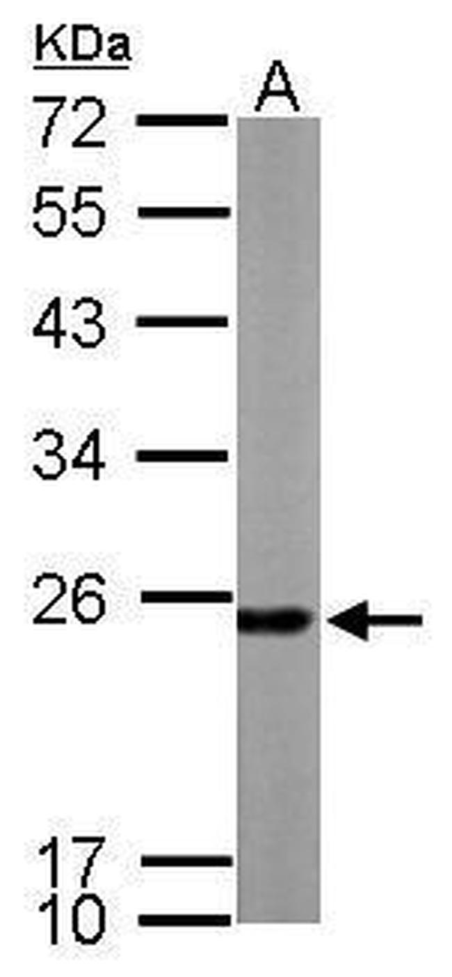 PRDX1 Antibody in Western Blot (WB)