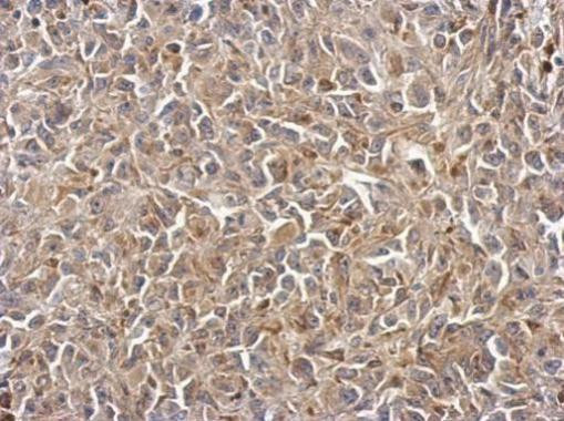 PKD2 Antibody in Immunohistochemistry (Paraffin) (IHC (P))