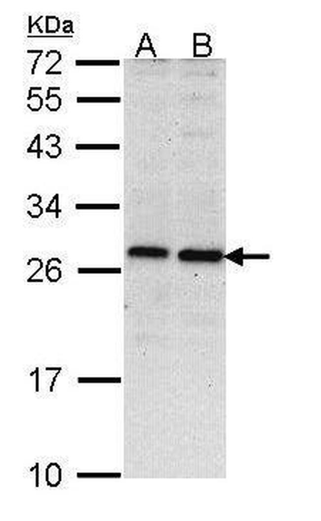 PSMD10 Antibody in Western Blot (WB)