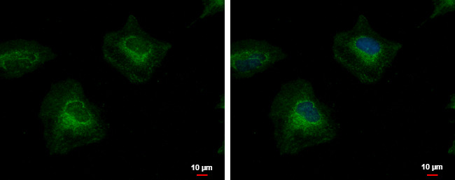 PTK7 Antibody in Immunocytochemistry (ICC/IF)