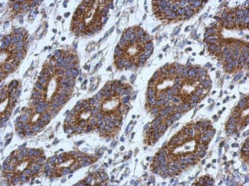 PTK7 Antibody in Immunohistochemistry (Paraffin) (IHC (P))