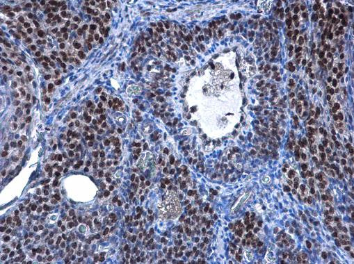 TBX5 Antibody in Immunohistochemistry (Paraffin) (IHC (P))