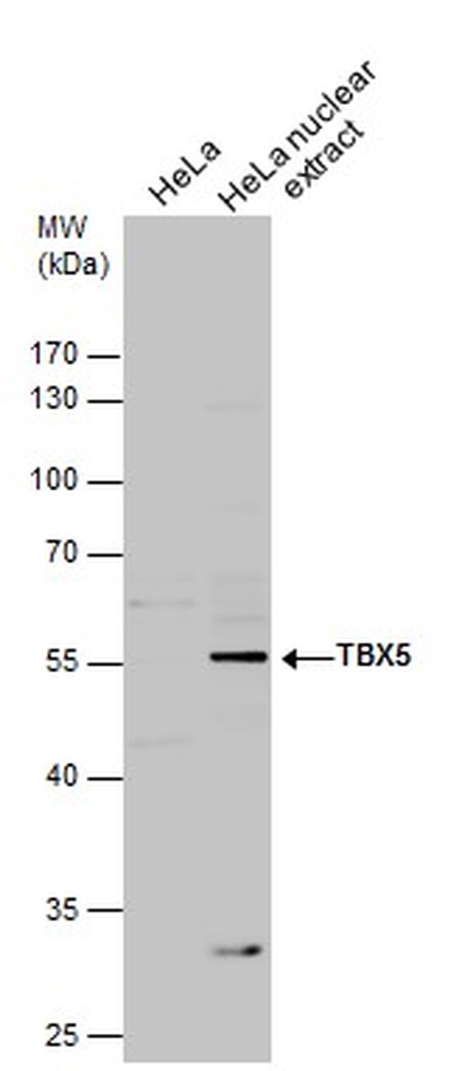 TBX5 Antibody in Western Blot (WB)