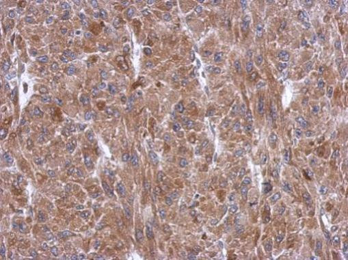 WARS Antibody in Immunohistochemistry (Paraffin) (IHC (P))