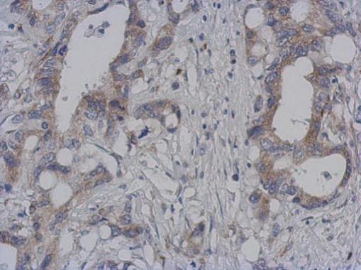 DAP3 Antibody in Immunohistochemistry (Paraffin) (IHC (P))