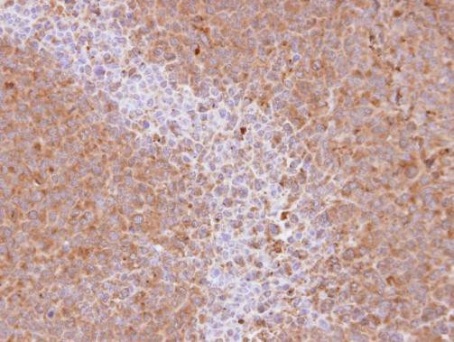 SRC3 Antibody in Immunohistochemistry (Paraffin) (IHC (P))