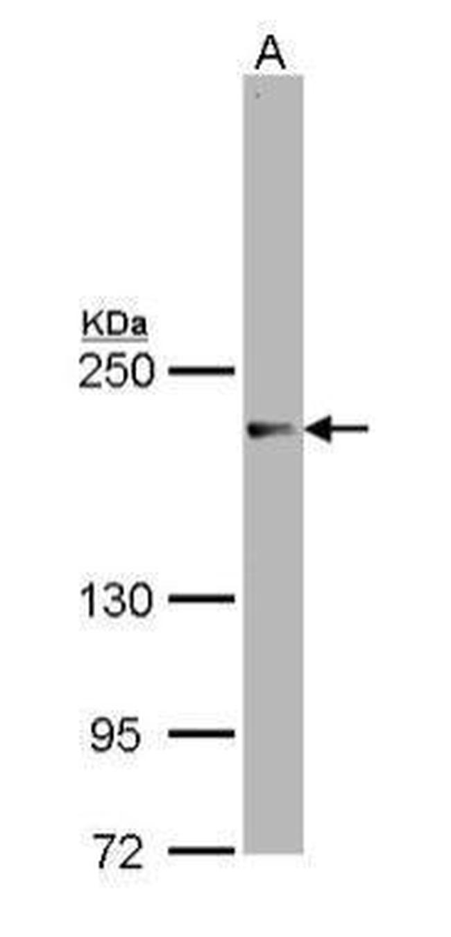 SRC3 Antibody in Western Blot (WB)