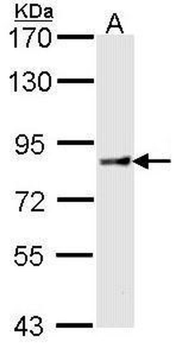 Cullin 4A Antibody in Western Blot (WB)