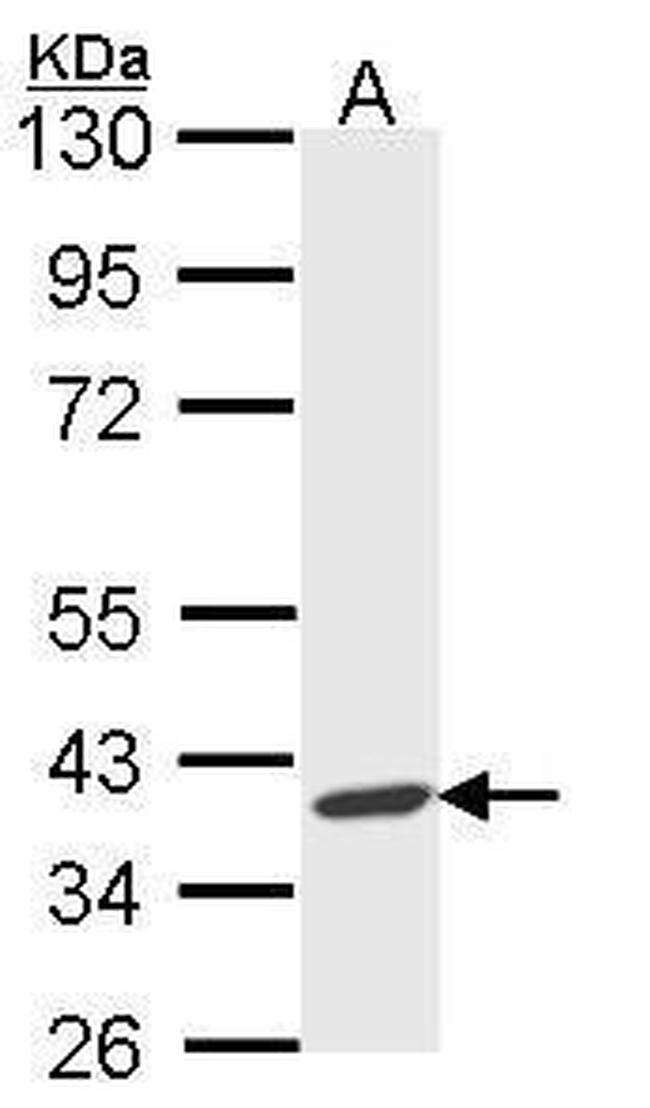 AIP Antibody in Western Blot (WB)