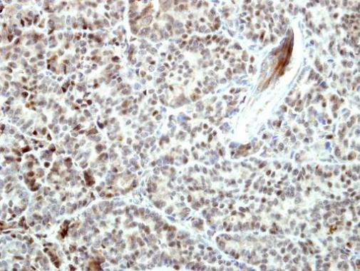 Bcl-B Antibody in Immunohistochemistry (Paraffin) (IHC (P))