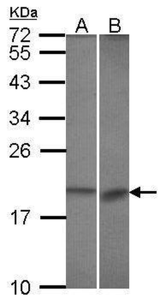 Bcl-B Antibody in Western Blot (WB)