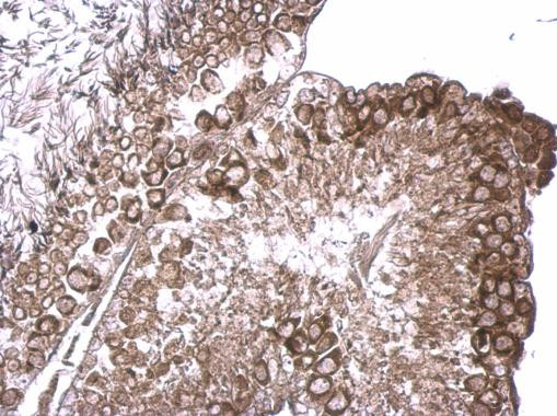 RUVBL2 Antibody in Immunohistochemistry (Paraffin) (IHC (P))