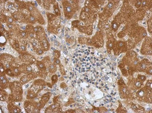 Calpain 10 Antibody in Immunohistochemistry (Paraffin) (IHC (P))