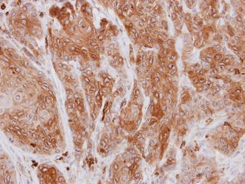 Coronin 1A Antibody in Immunohistochemistry (Paraffin) (IHC (P))