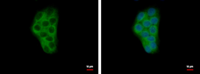 CHP1 Antibody in Immunocytochemistry (ICC/IF)