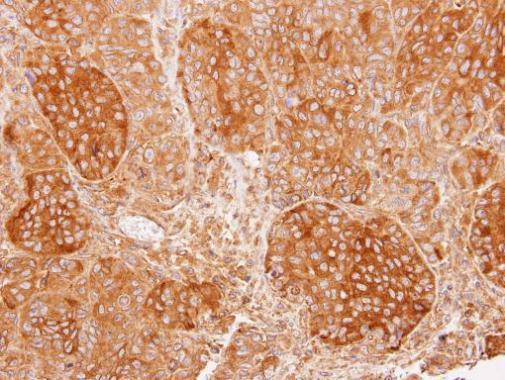 CHP1 Antibody in Immunohistochemistry (Paraffin) (IHC (P))