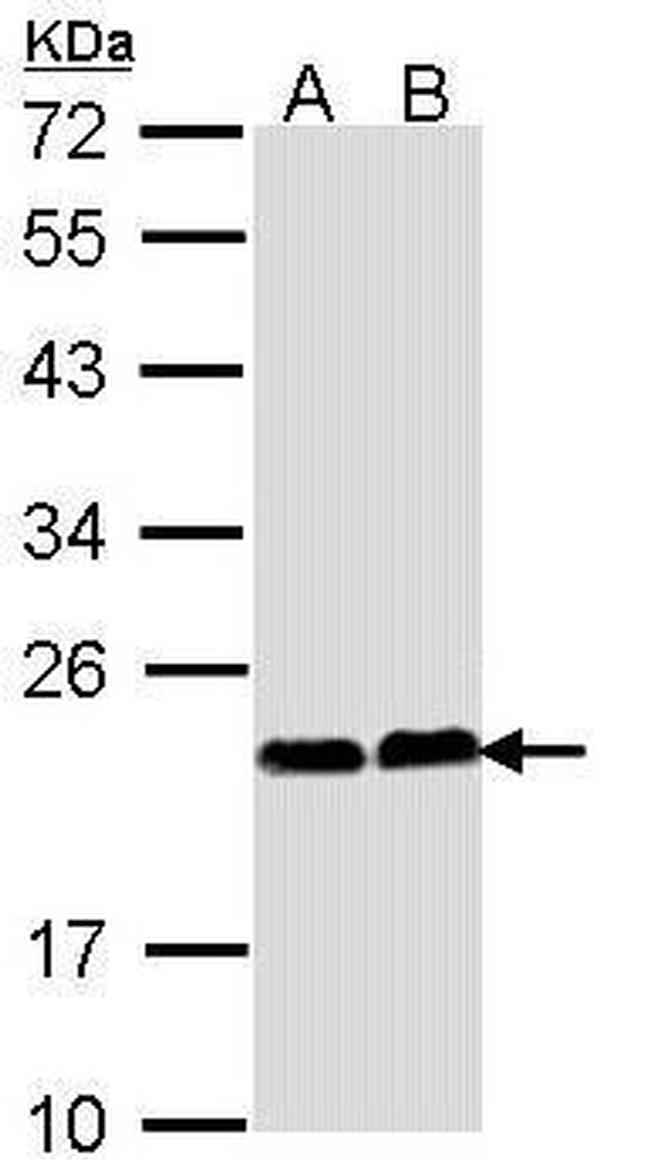 CHP1 Antibody in Western Blot (WB)