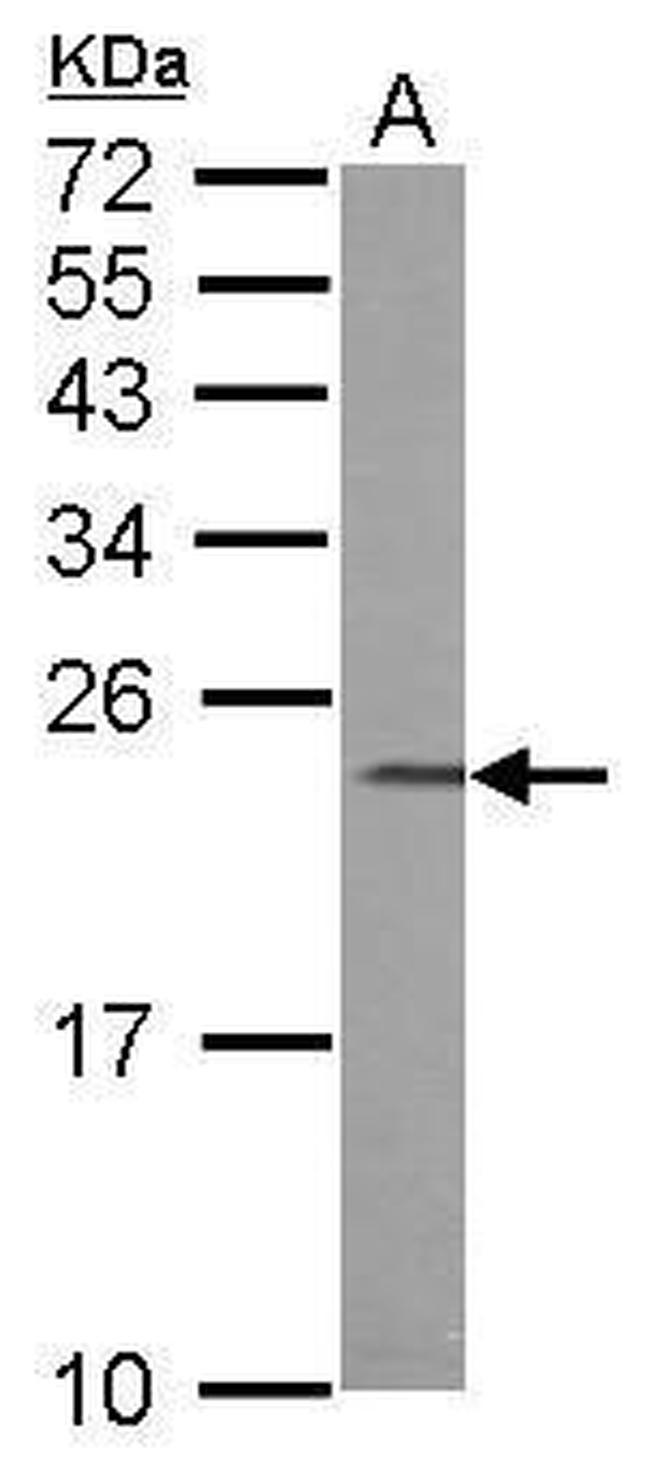 CHP1 Antibody in Western Blot (WB)