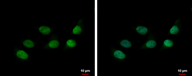 HP1 alpha Antibody in Immunocytochemistry (ICC/IF)