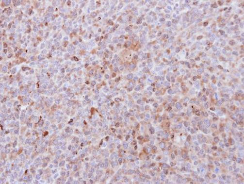 PADI4 Antibody in Immunohistochemistry (Paraffin) (IHC (P))