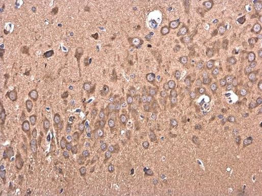 BACE2 Antibody in Immunohistochemistry (Paraffin) (IHC (P))